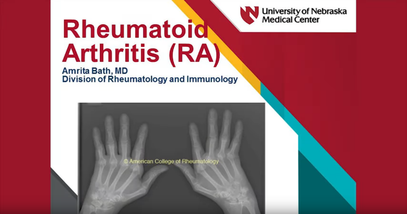 Rheumatoid Arthritis Nebraska Medicine Omaha, NE